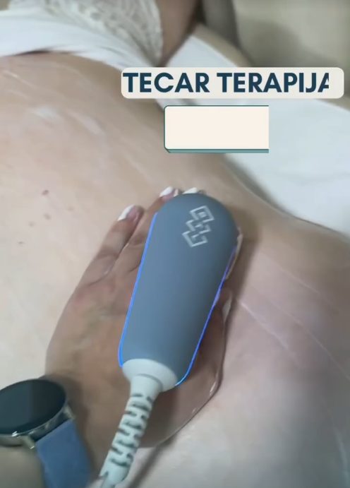 TECAR aparat u ordinaciji HELT Kruševac
